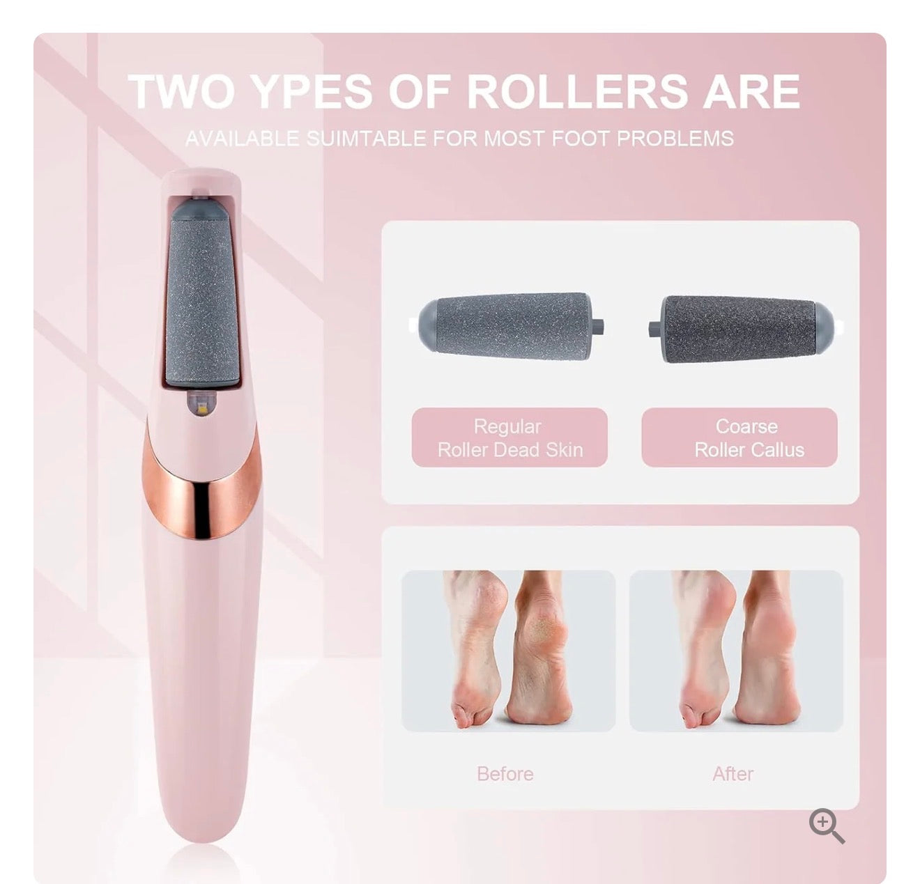 Electric Foot Callus Remover